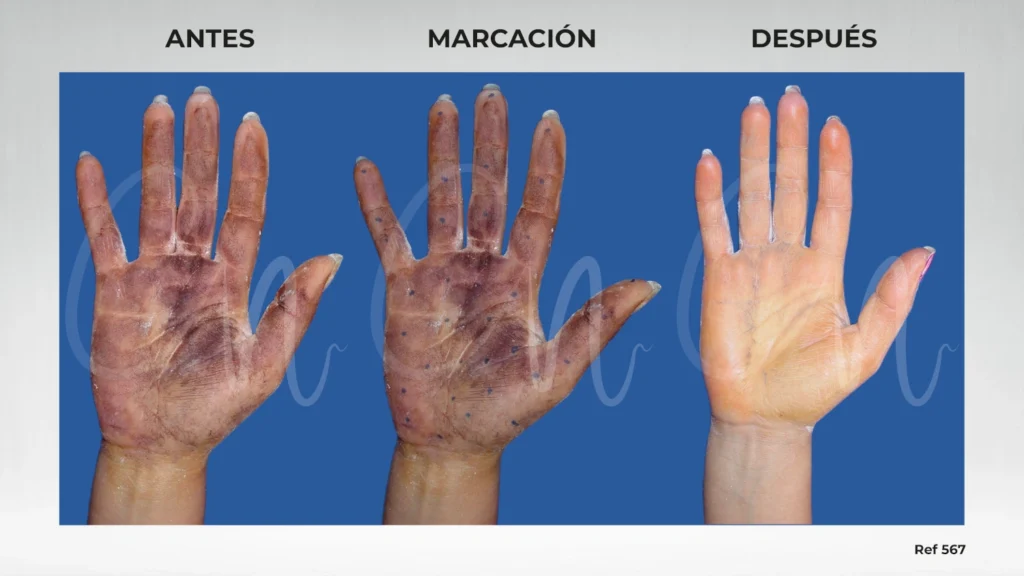 como evitar que te suden las manos al usar el celular